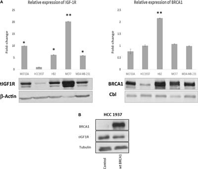 Identification of BRCA1 As a Potential Biomarker for Insulin-Like Growth Factor-1 Receptor Targeted Therapy in Breast Cancer